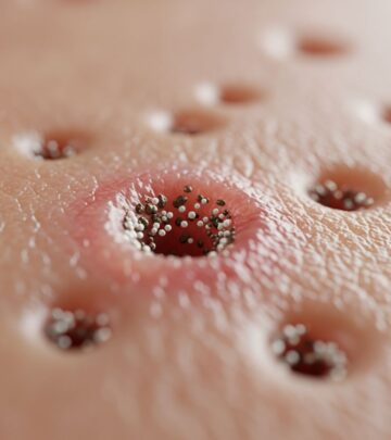 Learn what causes clogged pores, how to treat them, and effective prevention strategies.