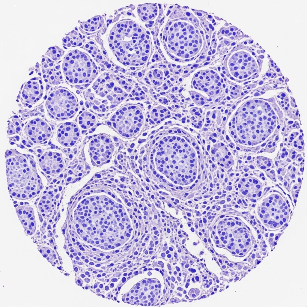 Comprehensive pathology of lymphomatoid papulosis: histological features, subtypes, and diagnostic insights for clinicians.