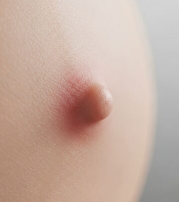 Discover common causes of itchy nipples, from benign skin issues to rare cancer signs, and when to seek medical help.