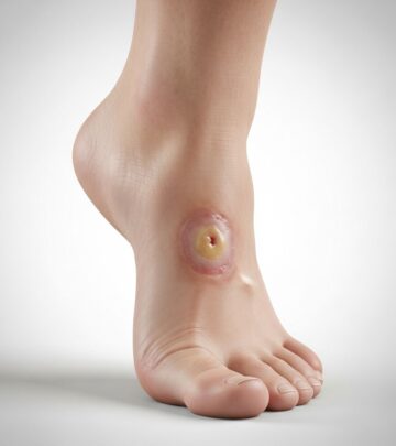 Comprehensive insights into preventing, recognizing, and treating diabetic foot ulcers to safeguard mobility and health.