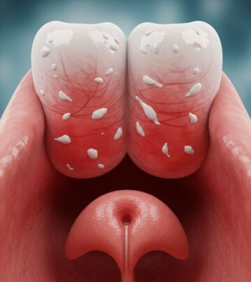 Discover symptoms, treatments, and prevention strategies for strep throat to recover quickly and avoid complications.